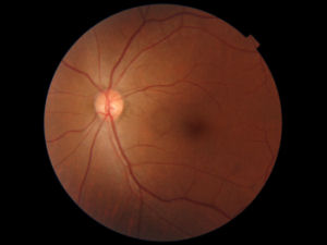 Example fundus image