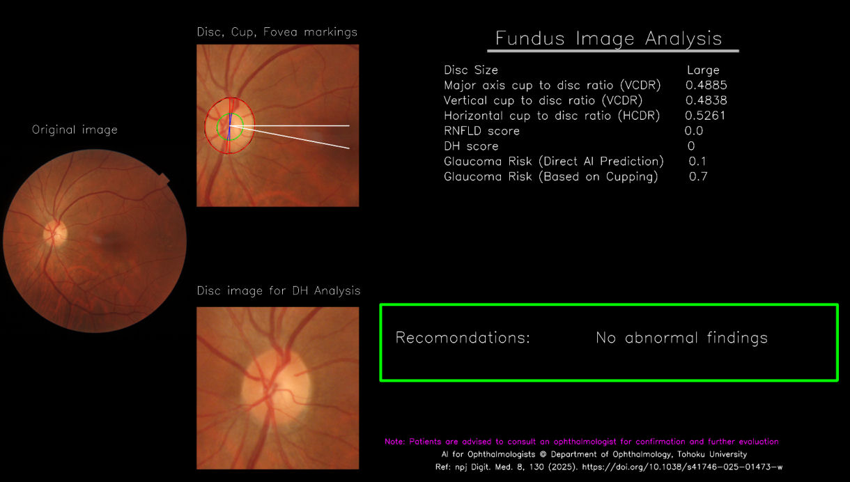 Example AIGS screening output